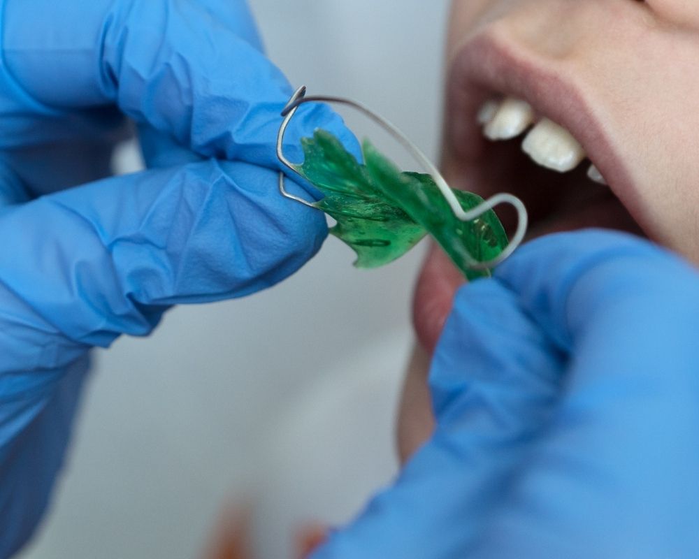 imagen de Ortodoncia Infantil en dental premia